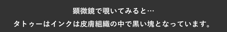顕微鏡で覗いてみると…タトゥーはインクは皮膚組織の中で黒い塊となっています。