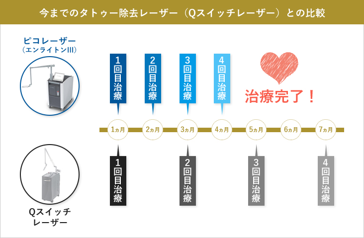 今までのタトゥー除去レーザー(Qスイッチレーザー)との比較