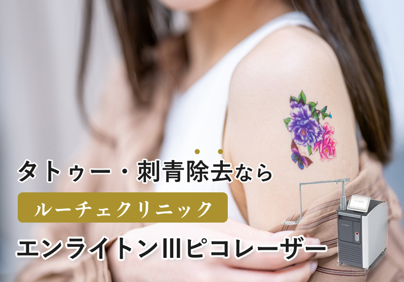 タトゥー・刺青除去ならルーチェクリニック エンラインⅢピコレーザーmv